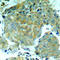 Eukaryotic Translation Initiation Factor 2 Subunit Alpha antibody, LS-C335983, Lifespan Biosciences, Immunohistochemistry paraffin image 