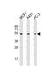 Protein Phosphatase 2 Regulatory Subunit B'Epsilon antibody, PA5-49465, Invitrogen Antibodies, Western Blot image 