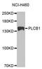 1-phosphatidylinositol-4,5-bisphosphate phosphodiesterase beta-1 antibody, MBS127114, MyBioSource, Western Blot image 