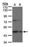 Carboxypeptidase B1 antibody, PA5-28204, Invitrogen Antibodies, Western Blot image 