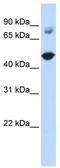 TBC1 Domain Family Member 16 antibody, TA344161, Origene, Western Blot image 