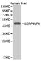 Serpin Family F Member 1 antibody, PA5-76054, Invitrogen Antibodies, Western Blot image 