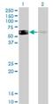 Rho GDP Dissociation Inhibitor Alpha antibody, H00002664-M12, Novus Biologicals, Western Blot image 