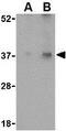 Emerin antibody, GTX85058, GeneTex, Western Blot image 