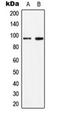 Signal Transducer And Activator Of Transcription 6 antibody, orb224013, Biorbyt, Western Blot image 