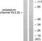 Potassium Voltage-Gated Channel Subfamily C Member 2 antibody, GTX87037, GeneTex, Western Blot image 