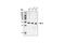BCL2 antibody, 2876S, Cell Signaling Technology, Western Blot image 