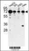 Phosphatase And Actin Regulator 2 antibody, 63-052, ProSci, Western Blot image 