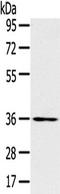 Solute Carrier Family 39 Member 9 antibody, TA351698, Origene, Western Blot image 