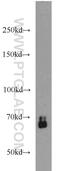 SMAD Family Member 4 antibody, 10231-1-AP, Proteintech Group, Western Blot image 