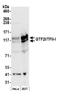 General Transcription Factor IIi antibody, NB500-157, Novus Biologicals, Western Blot image 