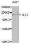 Tet Methylcytosine Dioxygenase 2 antibody, orb167514, Biorbyt, Western Blot image 