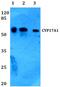 Cytochrome P450 Family 17 Subfamily A Member 1 antibody, PA5-75269, Invitrogen Antibodies, Western Blot image 