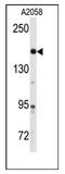 ABL Proto-Oncogene 2, Non-Receptor Tyrosine Kinase antibody, AP12556PU-N, Origene, Western Blot image 