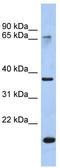 Annexin A10 antibody, TA341704, Origene, Western Blot image 