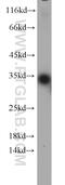 Thiopurine S-Methyltransferase antibody, 10682-1-AP, Proteintech Group, Western Blot image 