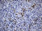 Receptor Tyrosine Kinase Like Orphan Receptor 2 antibody, LS-C792329, Lifespan Biosciences, Immunohistochemistry paraffin image 