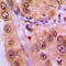 STAT3 antibody, LS-C354108, Lifespan Biosciences, Immunohistochemistry paraffin image 