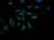 ADAM Metallopeptidase Domain 17 antibody, CSB-RA797631A0HU, Cusabio, Immunofluorescence image 