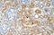 Serine Palmitoyltransferase Long Chain Base Subunit 1 antibody, ARP46721_P050, Aviva Systems Biology, Immunohistochemistry paraffin image 