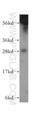 GAR1 Ribonucleoprotein antibody, 11711-1-AP, Proteintech Group, Western Blot image 