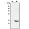 Crystallin Alpha B antibody, GTX57544, GeneTex, Western Blot image 