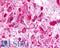 Adhesion G Protein-Coupled Receptor L3 antibody, LS-A1138, Lifespan Biosciences, Immunohistochemistry frozen image 