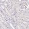 Lymphocyte-specific helicase antibody, HPA063242, Atlas Antibodies, Immunohistochemistry frozen image 