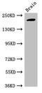 RB Binding Protein 6, Ubiquitin Ligase antibody, CSB-PA768776LA01HU, Cusabio, Western Blot image 