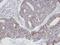 Actin Related Protein 2/3 Complex Subunit 3 antibody, NBP1-31422, Novus Biologicals, Immunohistochemistry paraffin image 