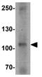 DIS3 Homolog, Exosome Endoribonuclease And 3'-5' Exoribonuclease antibody, GTX31880, GeneTex, Western Blot image 
