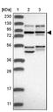 Ubiquitin Specific Peptidase 1 antibody, NBP1-85950, Novus Biologicals, Western Blot image 