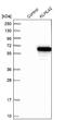 Kelch Like Family Member 42 antibody, NBP1-90612, Novus Biologicals, Western Blot image 