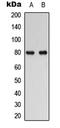 RAD17 Checkpoint Clamp Loader Component antibody, LS-C358271, Lifespan Biosciences, Western Blot image 