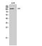 ACK1 antibody, A02334, Boster Biological Technology, Western Blot image 