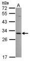 MAGE Family Member A4 antibody, NBP2-17204, Novus Biologicals, Western Blot image 