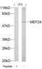 Myocyte Enhancer Factor 2A antibody, GTX50397, GeneTex, Western Blot image 