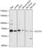 Solute Carrier Family 7 Member 1 antibody, GTX66289, GeneTex, Western Blot image 