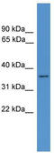 Histamine N-methyltransferase antibody, TA342675, Origene, Western Blot image 