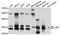 Gap Junction Protein Beta 1 antibody, STJ112151, St John