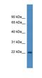 OFD1 Centriole And Centriolar Satellite Protein antibody, orb330985, Biorbyt, Western Blot image 