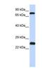 Zinc Finger Protein 799 antibody, NBP1-80201, Novus Biologicals, Western Blot image 