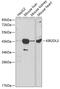Killer cell immunoglobulin-like receptor 2DL3 antibody, GTX54367, GeneTex, Western Blot image 