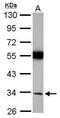 Torsin Family 1 Member A antibody, PA5-29729, Invitrogen Antibodies, Western Blot image 
