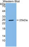 Talin 1 antibody, LS-C314451, Lifespan Biosciences, Western Blot image 