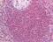 Protein Kinase C Alpha antibody, 49-690, ProSci, Immunohistochemistry paraffin image 