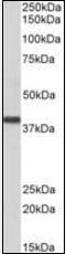 SET Nuclear Proto-Oncogene antibody, orb89331, Biorbyt, Western Blot image 
