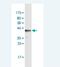 Sprouty Related EVH1 Domain Containing 2 antibody, H00200734-M03, Novus Biologicals, Western Blot image 