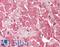 Clathrin Light Chain B antibody, LS-B11545, Lifespan Biosciences, Immunohistochemistry paraffin image 