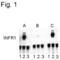 Interferon Alpha And Beta Receptor Subunit 1 antibody, PA1-4627, Invitrogen Antibodies, Western Blot image 